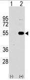 Sprouty Related EVH1 Domain Containing 1 antibody, AP11430PU-N, Origene, Western Blot image 