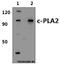 Phospholipase A2 Group IVA antibody, GTX66631, GeneTex, Western Blot image 