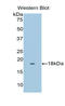 Myoglobin antibody, LS-C295482, Lifespan Biosciences, Western Blot image 