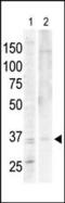 PKACA antibody, PA5-13737, Invitrogen Antibodies, Western Blot image 