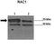 Rac Family Small GTPase 1 antibody, orb330944, Biorbyt, Western Blot image 