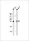 B Cell Receptor Associated Protein 31 antibody, M03767, Boster Biological Technology, Western Blot image 