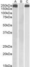 Thrombospondin 1 antibody, TA326717, Origene, Western Blot image 