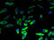 Lysophospholipase 2 antibody, A53989-100, Epigentek, Immunofluorescence image 