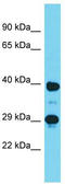 Doublesex- and mab-3-related transcription factor C2 antibody, TA329945, Origene, Western Blot image 