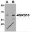 Growth factor receptor-bound protein 10 antibody, 6733, ProSci, Western Blot image 