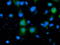 Alcohol Dehydrogenase 1B (Class I), Beta Polypeptide antibody, LS-C172895, Lifespan Biosciences, Immunofluorescence image 