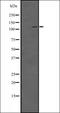 SET Domain Bifurcated Histone Lysine Methyltransferase 2 antibody, orb335376, Biorbyt, Western Blot image 