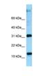 Ribosomal Protein L22 antibody, orb331236, Biorbyt, Western Blot image 