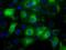 UPF0663 transmembrane protein C17orf28 antibody, MA5-25164, Invitrogen Antibodies, Immunocytochemistry image 