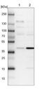 Failed Axon Connections Homolog, Metaxin Like GST Domain Containing antibody, NBP1-90579, Novus Biologicals, Western Blot image 