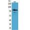 Forkhead Box P1 antibody, LS-C386980, Lifespan Biosciences, Western Blot image 