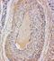 Versican antibody, PA1755, Boster Biological Technology, Immunohistochemistry paraffin image 