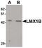 LIM Homeobox Transcription Factor 1 Beta antibody, PA5-34471, Invitrogen Antibodies, Western Blot image 