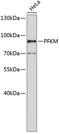 Phosphofructokinase, Muscle antibody, 18-483, ProSci, Western Blot image 