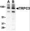 Transient Receptor Potential Cation Channel Subfamily C Member 3 antibody, orb86544, Biorbyt, Western Blot image 