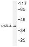 Pro-Apoptotic WT1 Regulator antibody, AP01439PU-N, Origene, Western Blot image 