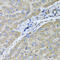 UDP Glucuronosyltransferase Family 2 Member B10 antibody, 23-033, ProSci, Immunohistochemistry paraffin image 