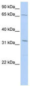 E3 ubiquitin-protein ligase TRIM22 antibody, TA343580, Origene, Western Blot image 