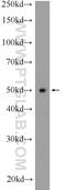 Thioredoxin Interacting Protein antibody, 18243-1-AP, Proteintech Group, Western Blot image 