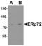 Protein disulfide-isomerase A4 antibody, LS-C358487, Lifespan Biosciences, Western Blot image 