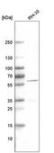 Desmin antibody, AMAb91302, Atlas Antibodies, Western Blot image 