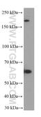 Forkhead Box N1 antibody, 66337-1-Ig, Proteintech Group, Western Blot image 