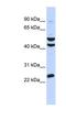 Zinc Finger Protein 200 antibody, NBP1-80301, Novus Biologicals, Western Blot image 