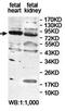 Leukocyte Receptor Cluster Member 8 antibody, orb78372, Biorbyt, Western Blot image 