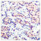 JunD Proto-Oncogene, AP-1 Transcription Factor Subunit antibody, LS-C118169, Lifespan Biosciences, Immunohistochemistry paraffin image 