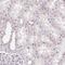 Regulation Of Nuclear Pre-MRNA Domain Containing 1B antibody, HPA066290, Atlas Antibodies, Immunohistochemistry frozen image 