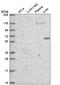 DEP Domain Containing 1B antibody, HPA072558, Atlas Antibodies, Western Blot image 