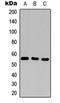CD25 antibody, orb256622, Biorbyt, Western Blot image 