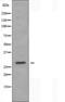 Carbonic Anhydrase 5A antibody, orb226404, Biorbyt, Western Blot image 