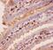 Angiopoietin 2 antibody, RP1037, Boster Biological Technology, Immunohistochemistry paraffin image 