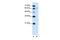 Solute carrier family 15 member 4 antibody, GTX46773, GeneTex, Western Blot image 