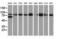 Catenin Beta 1 antibody, LS-C172639, Lifespan Biosciences, Western Blot image 