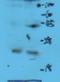 Killer Cell Lectin Like Receptor C2 antibody, orb13612, Biorbyt, Western Blot image 