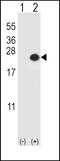 Dual Specificity Phosphatase 3 antibody, LS-C101091, Lifespan Biosciences, Western Blot image 