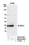 MIS12 Kinetochore Complex Component antibody, NB100-2358, Novus Biologicals, Western Blot image 