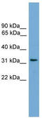 Coiled-Coil Domain Containing 117 antibody, TA337783, Origene, Western Blot image 