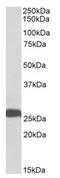 Ubiquitin C-Terminal Hydrolase L1 antibody, AP21291PU-N, Origene, Western Blot image 