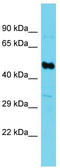 Succinate-CoA Ligase GDP-Forming Beta Subunit antibody, TA333887, Origene, Western Blot image 