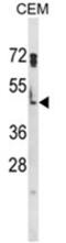 HSP70B antibody, AP18060PU-N, Origene, Western Blot image 