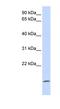 Zymogen Granule Protein 16 antibody, NBP1-58007, Novus Biologicals, Western Blot image 