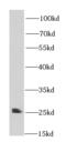 Heat Shock Protein Family B (Small) Member 11 antibody, FNab04156, FineTest, Western Blot image 