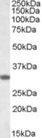 Four And A Half LIM Domains 3 antibody, TA305761, Origene, Western Blot image 