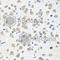 Phosphatidylinositol-5-phosphate 4-kinase type-2 beta antibody, A8016, ABclonal Technology, Immunohistochemistry paraffin image 