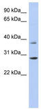 Homeobox C5 antibody, TA345264, Origene, Western Blot image 