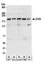 Glutamyl-Prolyl-TRNA Synthetase antibody, NBP2-22311, Novus Biologicals, Western Blot image 